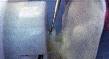 Как снять сеточку бензонасоса на Лада Веста